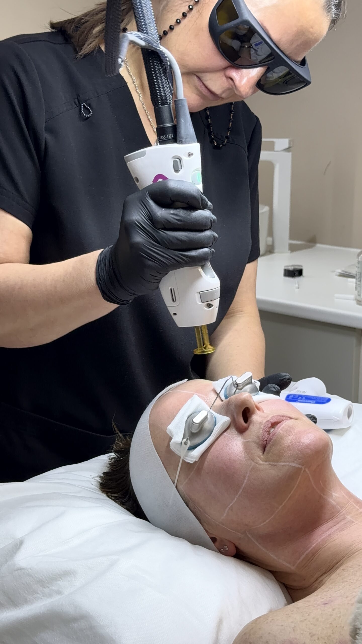Laser Skin Rejuvenation - Before treatment
