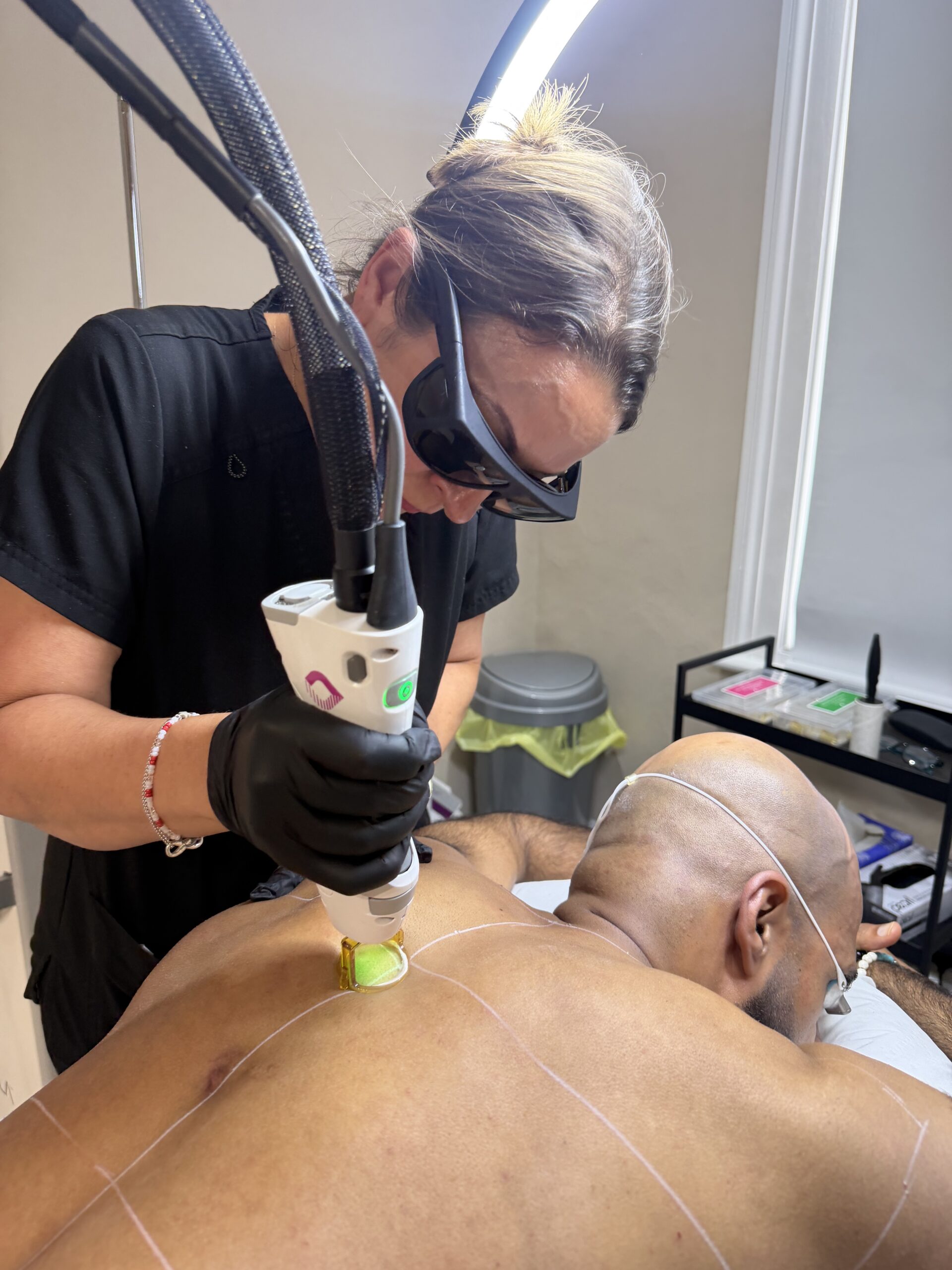 Candela GentleMax Pro Plus laser treatment area at Stockley Clinic