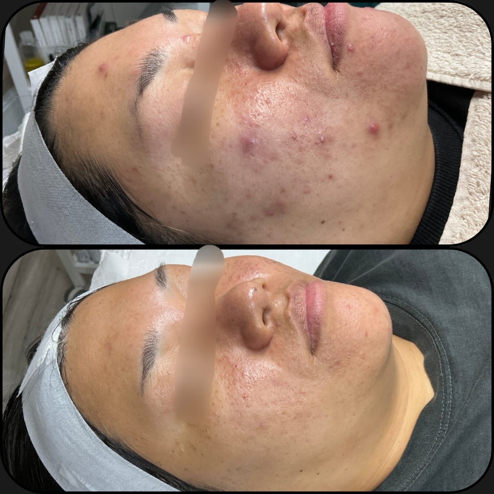 Stockley Clinic practitioner consultation for Aquaderm treatment in Maidenhead
