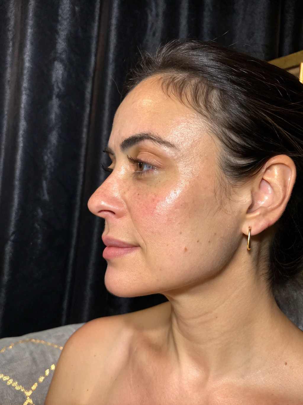 Client skin after Aquaderm course showing luminous and smooth appearance
