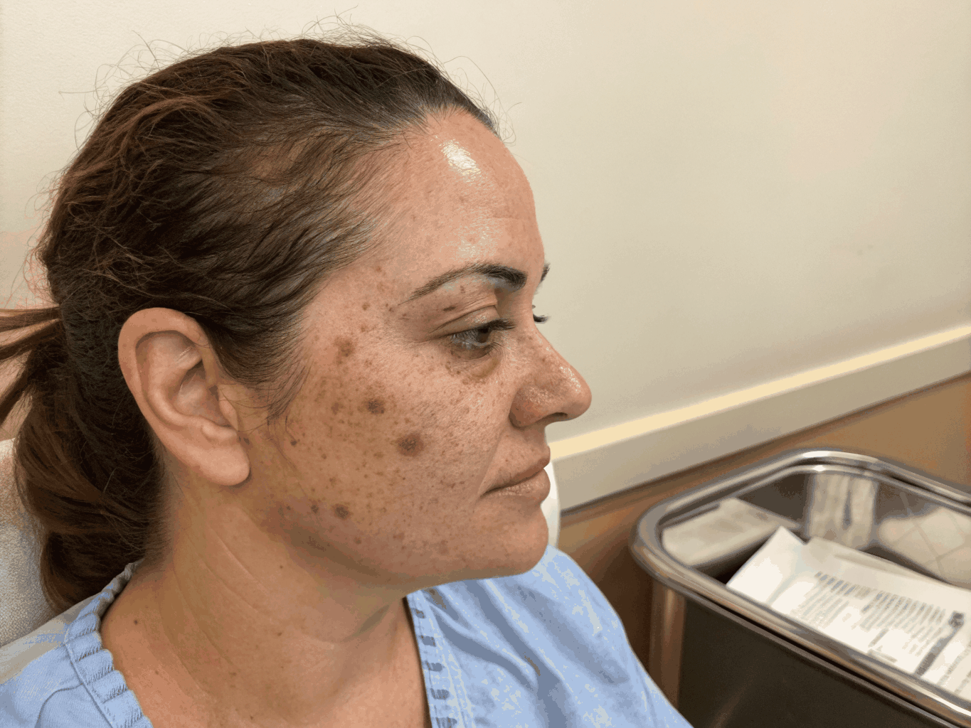 Pigmentation & Sun Damage